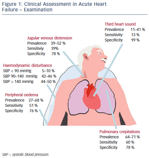 Clinical Assessment In Acute Heart Failure Examination Radcliffe
