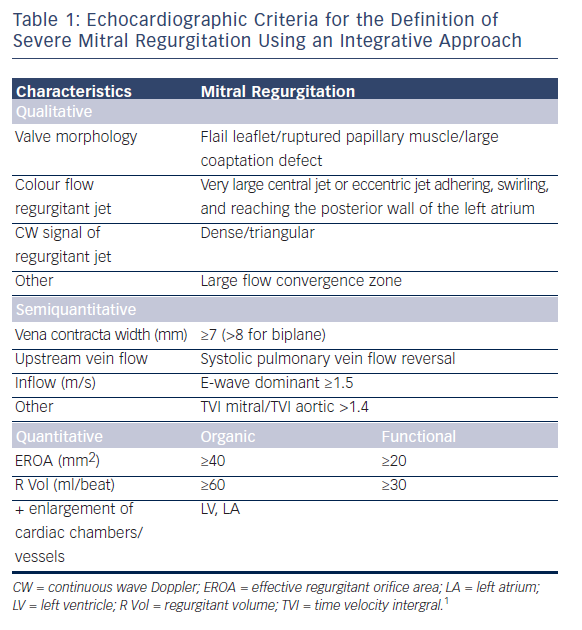 Mitral Stenosis Echo Criteria