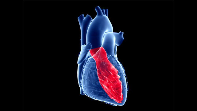 Cardiac Imaging for Assessment of Left Ventricular Thrombus