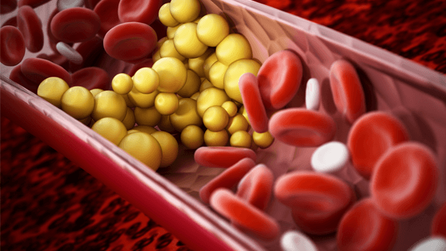 Understanding Cholesterol Synthesis and Absorption Is the Key to Achieving Cholesterol Targets