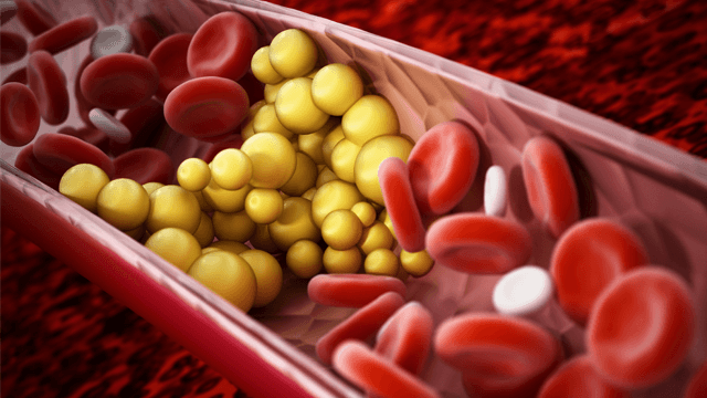 Dyslipidemia: Current Therapies and Guidelines for Treatment