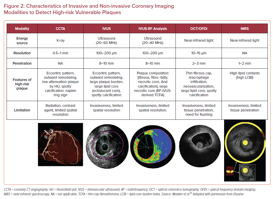 Characteristics Of Invasive And Non-invasive Coronary Imaging ...