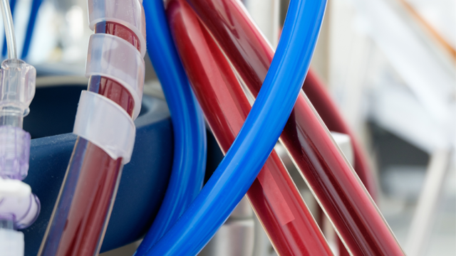 VA-ECMO as a Treatment for Right Heart Catheterisation-related PA Injury