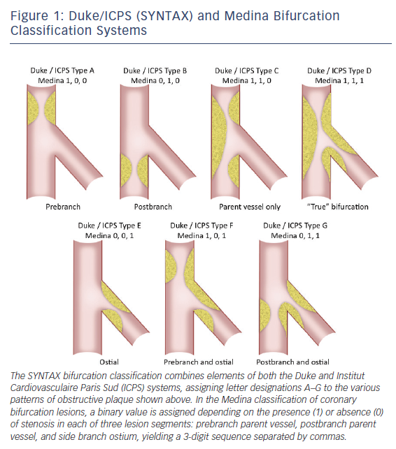 Overview Of Technical And Cost Considerations In Complex Percutaneous ...