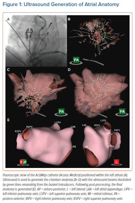 Ultrasound Generation Of Atrial Anatomy Radcliffe Cardiology   Figure1 Ultrasound Generation 