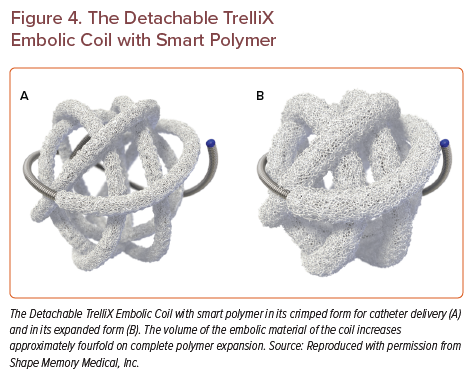 The Detachable TrelliX Embolic Coil With Smart Polymer | Radcliffe Vascular