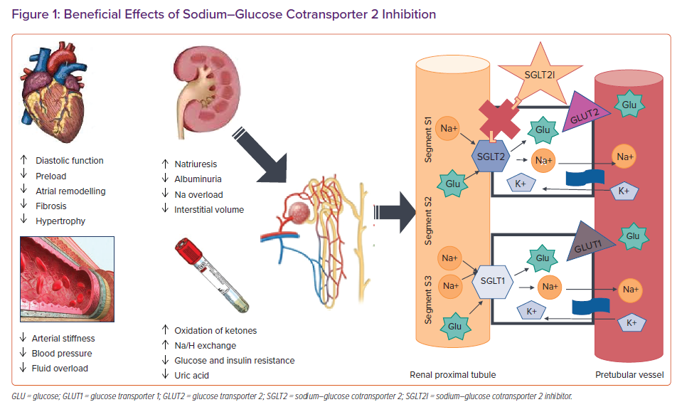 Glucose Sodium Cotransporter Diagram