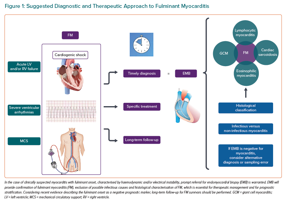 Suggested Diagnostic And Therapeutic Approach To Fulminant Myocarditis ...