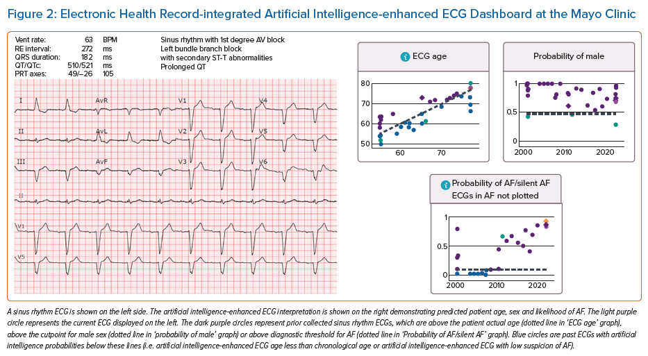 Electronic Health Record-integrated Artificial Intelligence-enhanced ...