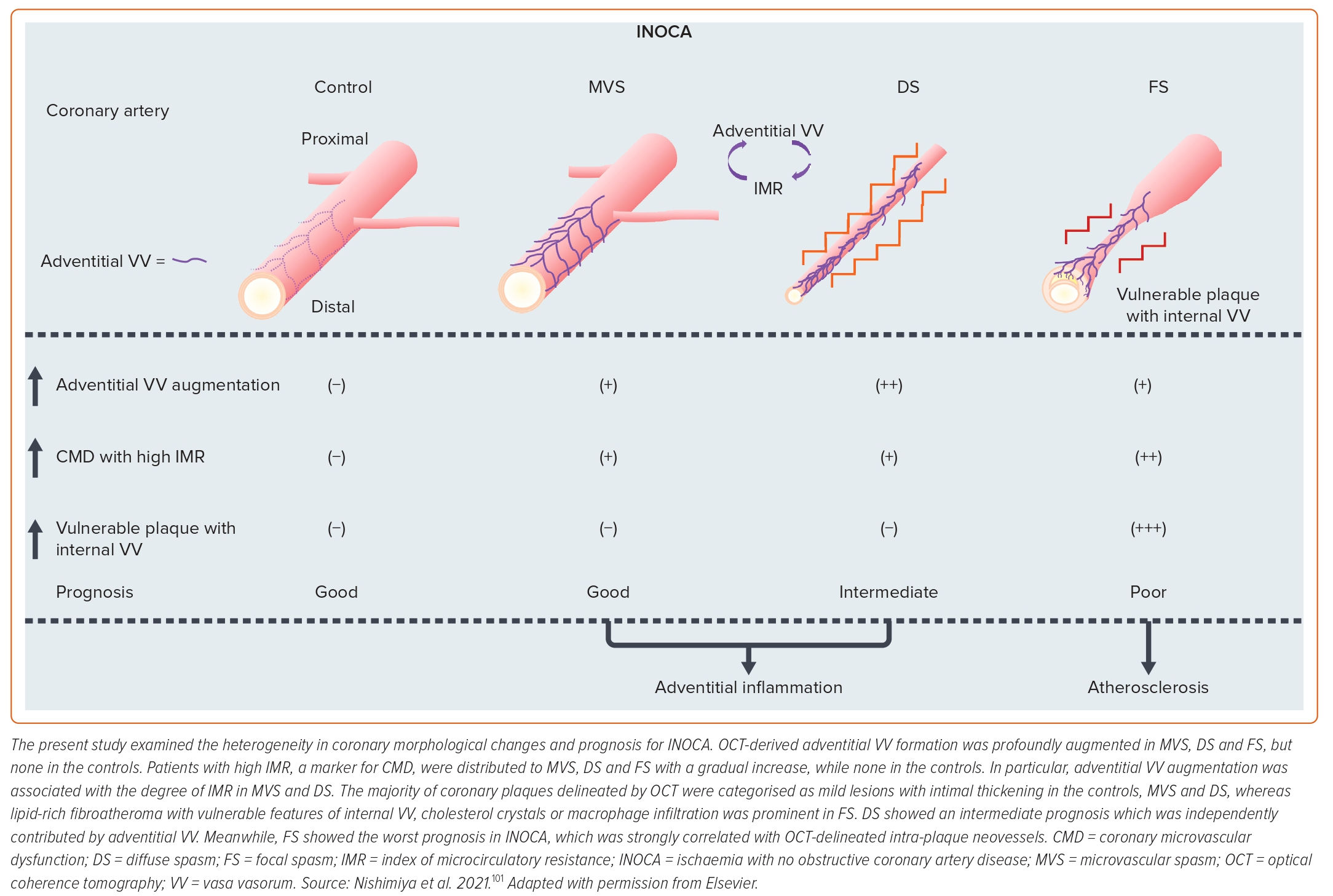 Figure 6: Coronary Artery Morphologies And Prognosis For Ischaemia With ...