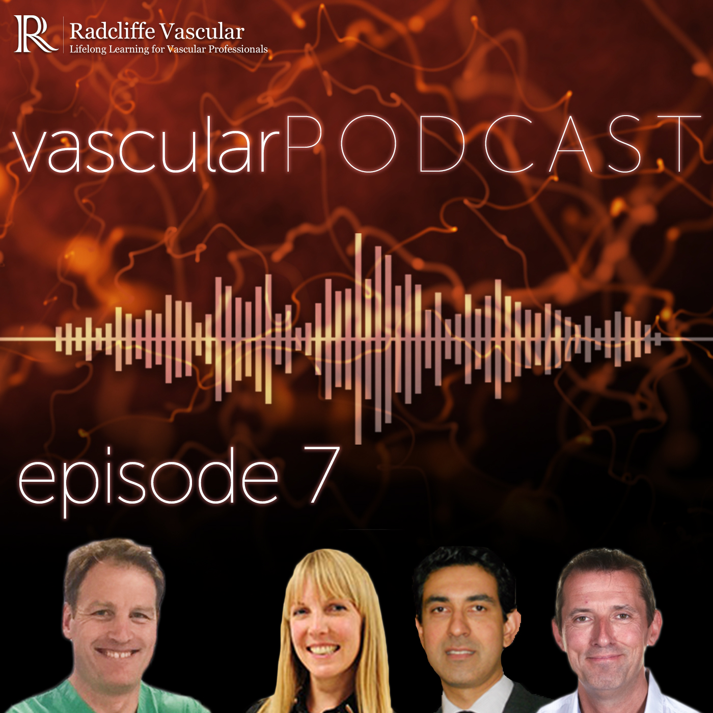 Ep 7: AAA: Appropriateness and Treatment Options Post-NICE | abdominal aortic aneurysm