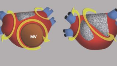 Atrial Flutter, Typical and Atypical: A Review
