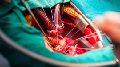 Clinical Trial Perspective: Cost-effectiveness of Transcatheter Mitral Valve Repair Versus Medical Therapy in Patients with Heart Failure and Secondary Mitral Regurgitation. Results From the COAPT Trial