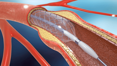 Drug-coated Balloons for Small Coronary Vessel Interventions: A Literature Review