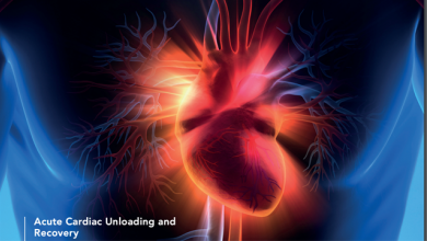 How to Unload the Heart on Extracorporeal Membrane Oxygenation
