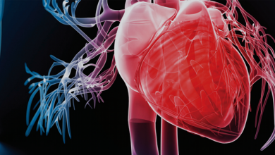 Iron Deficiency, a Common Neglected Burden in Heart Failure
