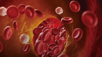 NOACs and Dual Antiplatelet Therapy