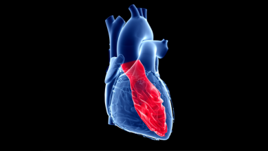 Aortic Stenosis and Non-cardiac Surgery