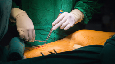 MIDCAB, TECAB and Hybrid Coronary Revascularisation Surgery