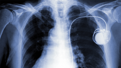 Is There a Future for Remote Cardiac Implantable Electronic Device Management?
