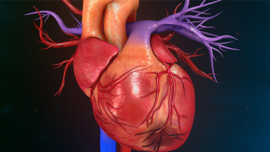 Myocardial Infarction With Non-obstructive Coronary Arteries