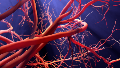 Microvascular Angina: Diagnosis and Management