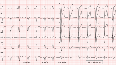 Electro-energetics of Biventricular, Septal and Conduction System Pacing