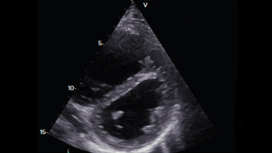 Echocardiography in the Evaluation of the Right Heart