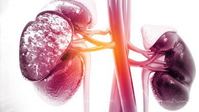 Management of HF in Patients with CKD