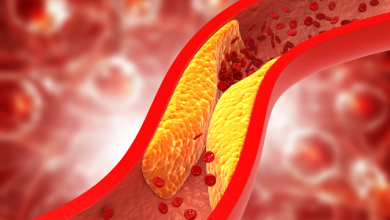 NF-kB in Cardiovascular Disease