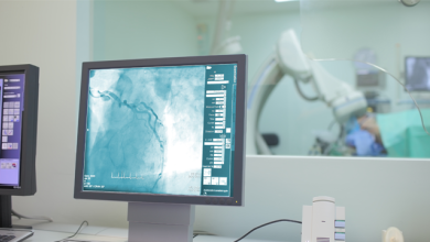 Radiographic Predictors of Successful Radial Access Coronary Angiography