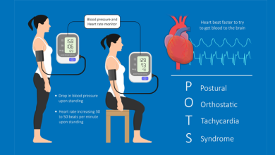 Narrative Review of Postural Orthostatic Tachycardia Syndrome: Associated Conditions and Management Strategies
