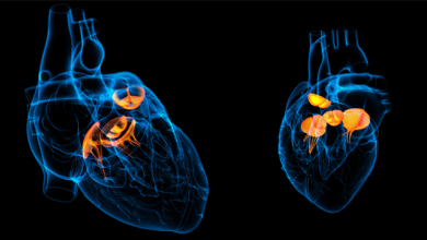 Mitral and Tricuspid Transcatheter Edge-to-Edge Repair