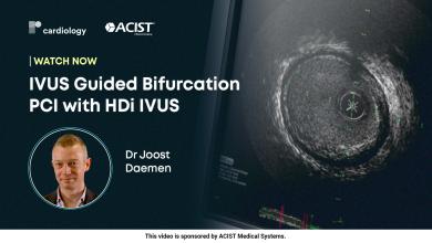 IVUS Guided Bifurcation PCI with HDi IVUS