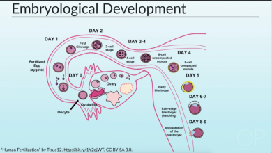 Clinical Presentation of Congenital Heart Disease: Congestive Heart Failure