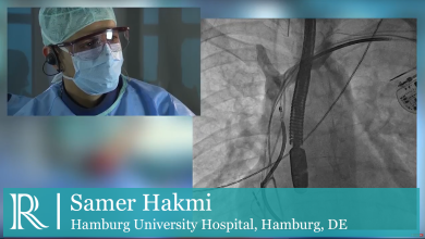 Percutaneous Lead Extraction - Dr. Samer Hakmi