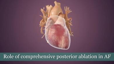Role of Comprehensive Posterior Ablation in AF