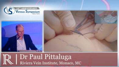 VS 2019 - Mini-Phlebectomy - Dr Paul Pittaluga