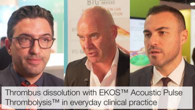 Thrombus Dissolution with EKOS™ Acoustic Pulse Thrombolysis™ in Everyday Clinical Practice