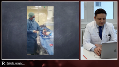 Treating Calcified Lesions Using The Shockwave Lithoplasty® System - Prof K Donas