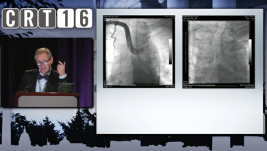 CRT 2016 Coronary - My Most Complex Vascular Access Cases