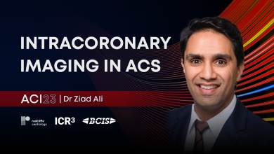 Intracoronary Imaging in Acute Coronary Syndromes