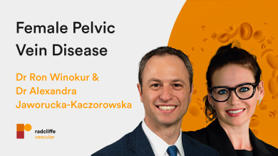 Female Pelvic Vein Disease