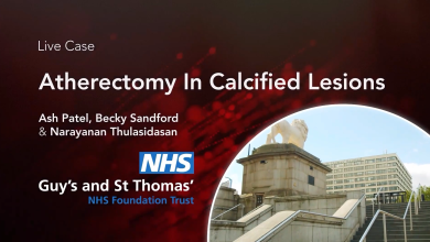Atherectomy in Calcified Lesions