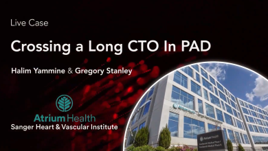 Crossing a Long CTO in PAD