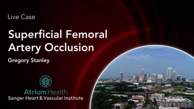 Superficial Femoral Artery Occlusion