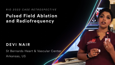 Rhythm Interventions Online 2022 – Case Retrospective: Pulsed Field and Radiofrequency Ablation of Atrial Fibrillation Using Novel Focal Lattice Tip Catheter with Zero Fluoroscopy