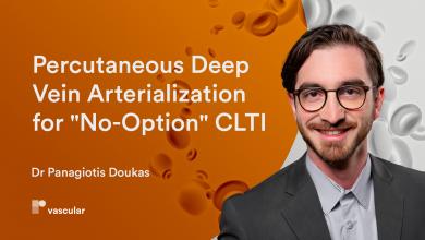 Percutaneous Deep Vein Arterialization for "No-Option" CLTI