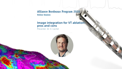 Image Integration for VT Ablation: Pros and Cons