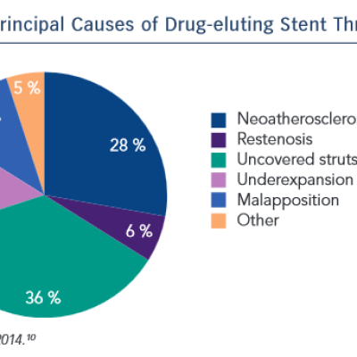 Principal Causes of Drug-eluting Stent Thrombosis